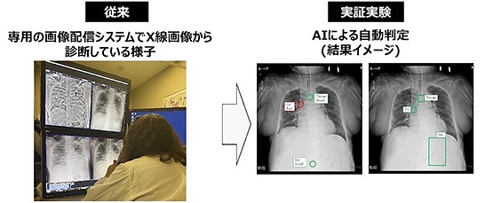 気管内チューブなどの位置をAIで自動判定（出典：NTTドコモプレスリリース）　イメージ