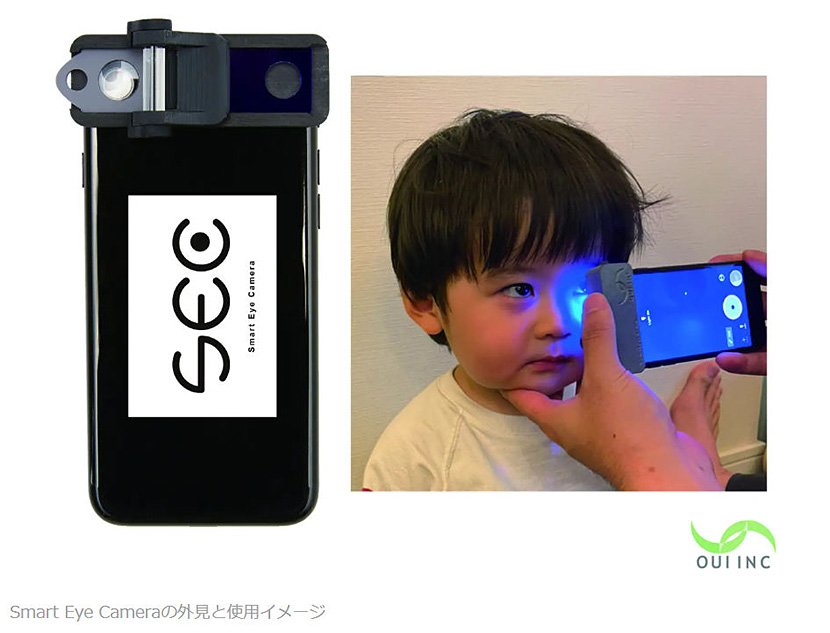 （図2）「Smart Eye Camera（SEC）」（出典：OUI Inc）　イメージ